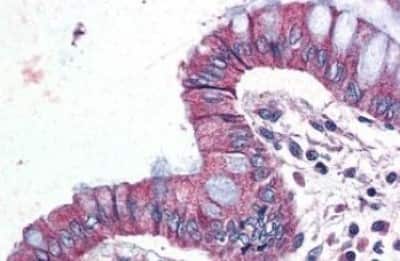 Immunohistochemistry-Paraffin: GPR116 Antibody [NBP3-14343] - GPR116 antibody IHC of human colon. Immunohistochemistry of formalin-fixed, paraffin-embedded tissue after heat-induced antigen retrieval.